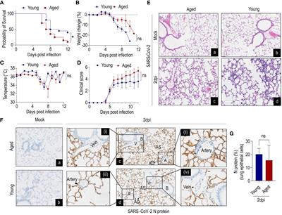 Aging is associated with an insufficient early inflammatory response of lung endothelial cells in SARS-CoV-2 infection